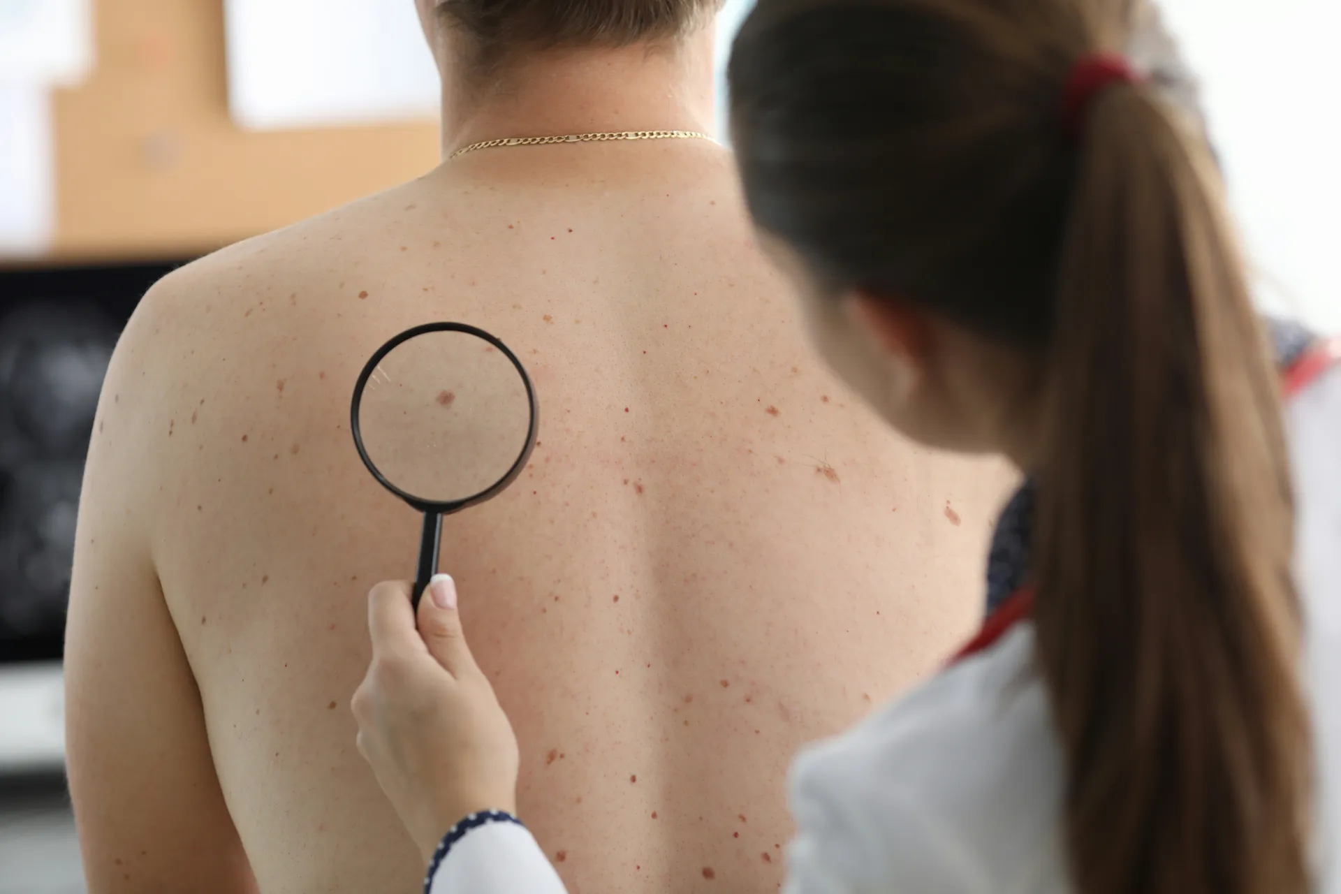 Dermatologist performing a full body skin exam with a dermatoscope