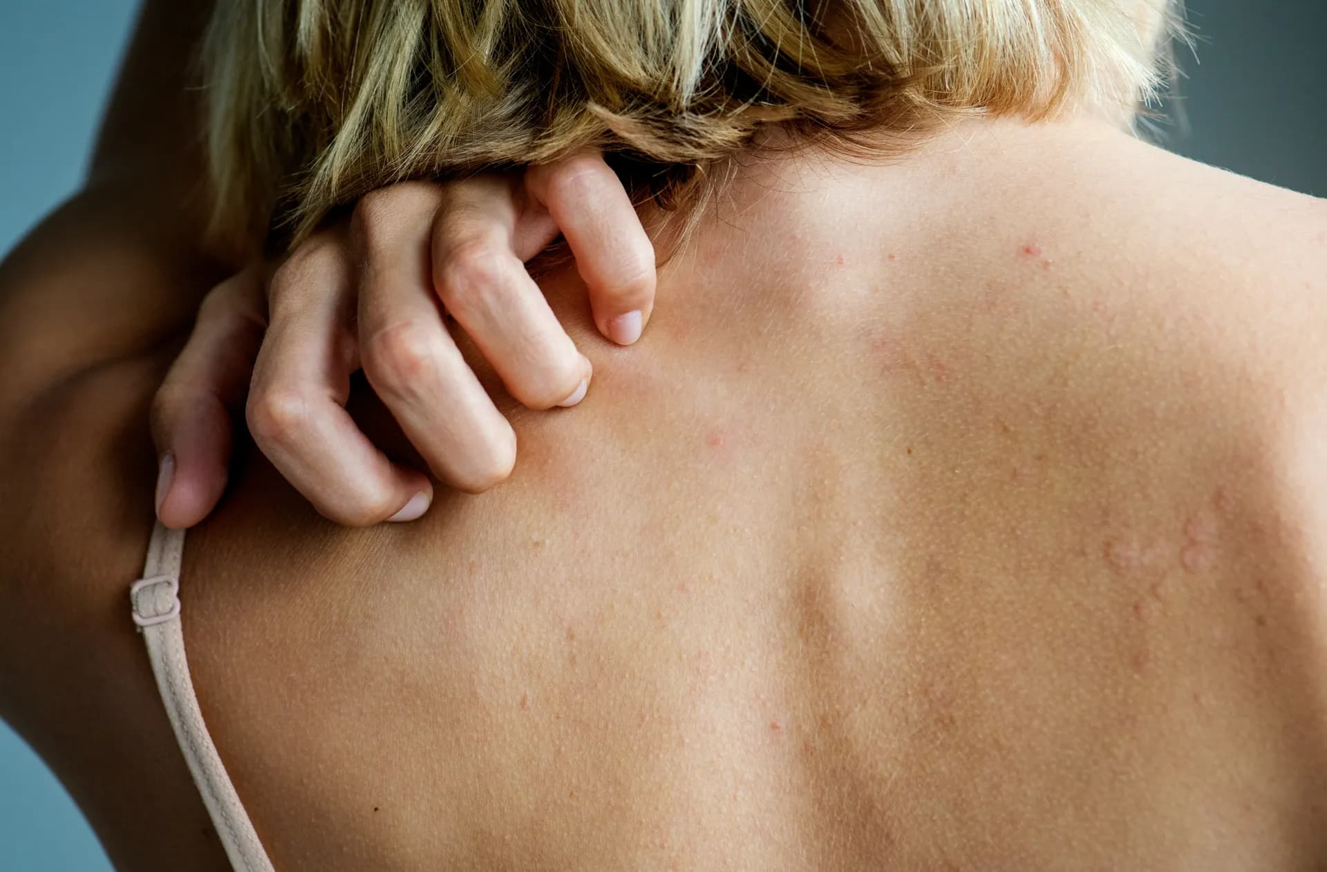 Dermatologist examining a skin rash