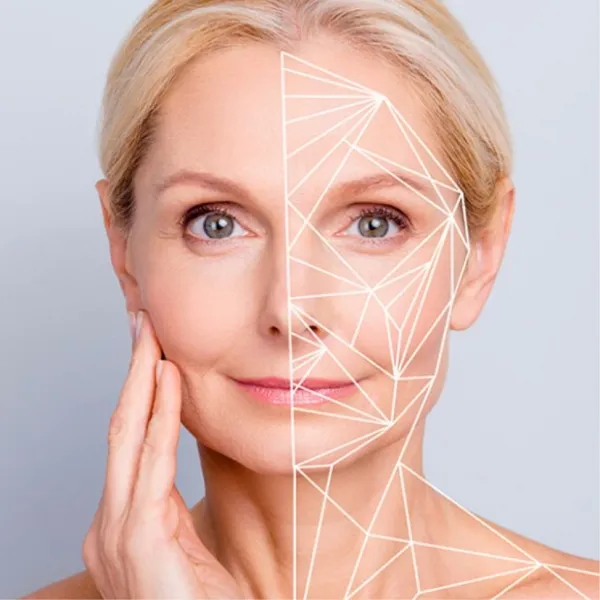 Patient with SkinMap facial mapping lines over half of her face